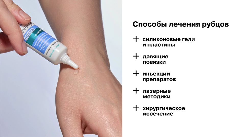 Способы лечения рубцов