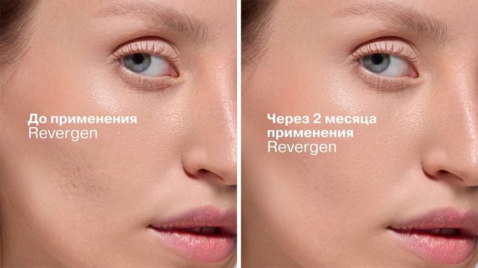 До/после