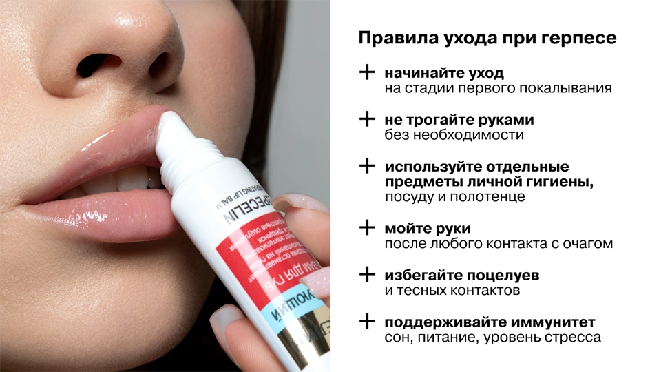 Правила ухода при герпесе